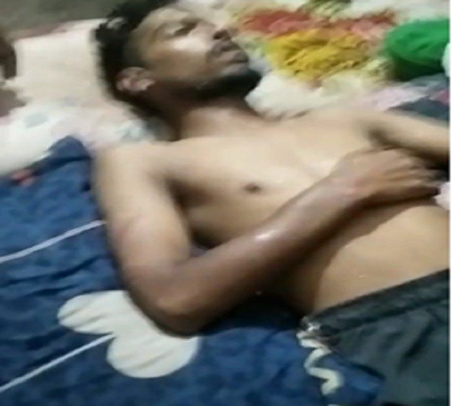 Punjab: पंजाब पुलिस ने 17 वर्षीय युवक को दिया थर्ड डिग्री टॉर्चर, देखें तस्वीरें पंजाब पुलिस ने 17 वर्षीय युवक को दिया थर्ड डिग्री टॉर्चर